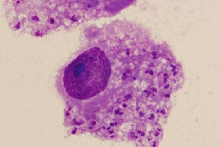 Cientistas identificam novo parasita que já infectou mais de cem pessoas no Nordeste