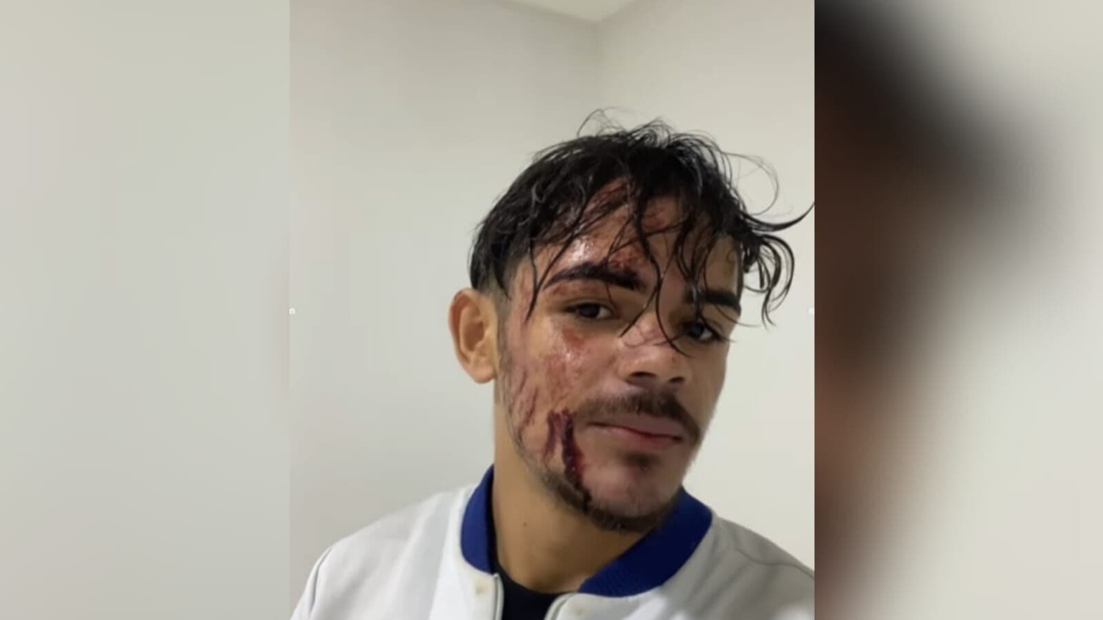 Delegado designa equipe para localizar motoboy que acusa cliente de jogar açaí; profissional pode responder por calúnia e difamação