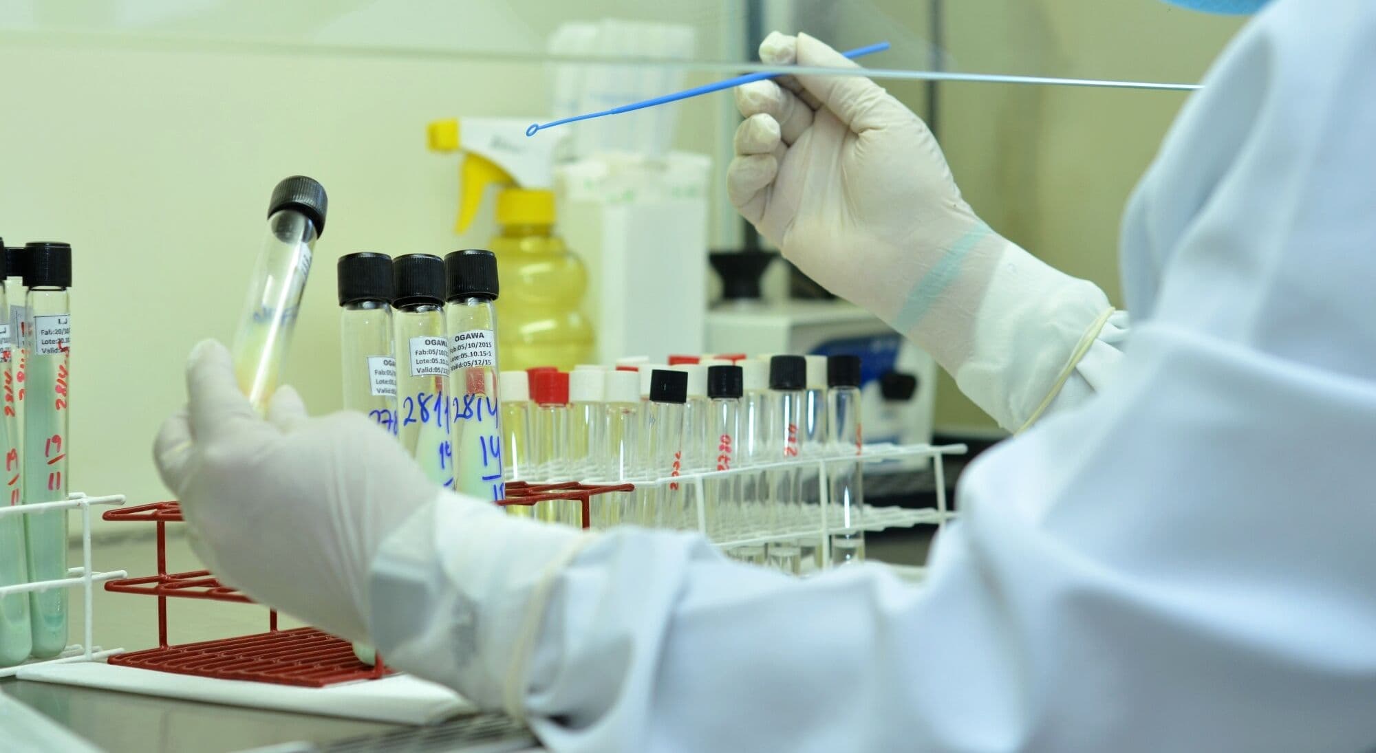 Casos de zika aumentam 25% na Paraíba