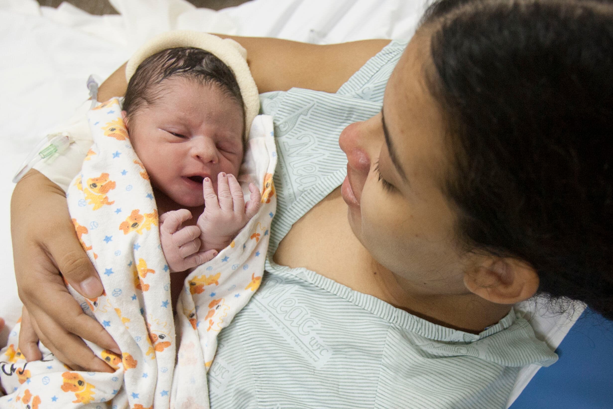 Bebês com zika podem desenvolver microcefalia após nascimento, diz estudo