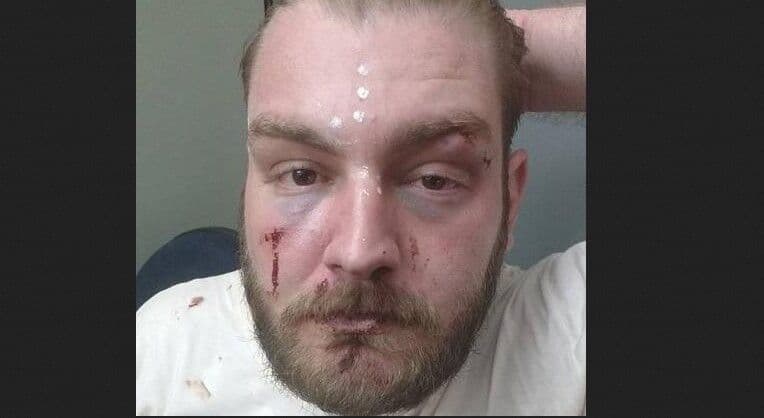 Policiais militares são afastados após quebrarem braço de petista em delegacia