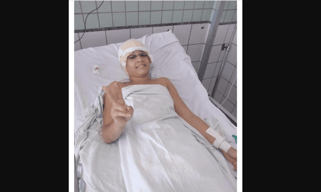 Jovem que teve couro cabeludo arrancado em kart é transferida do Recife para SP