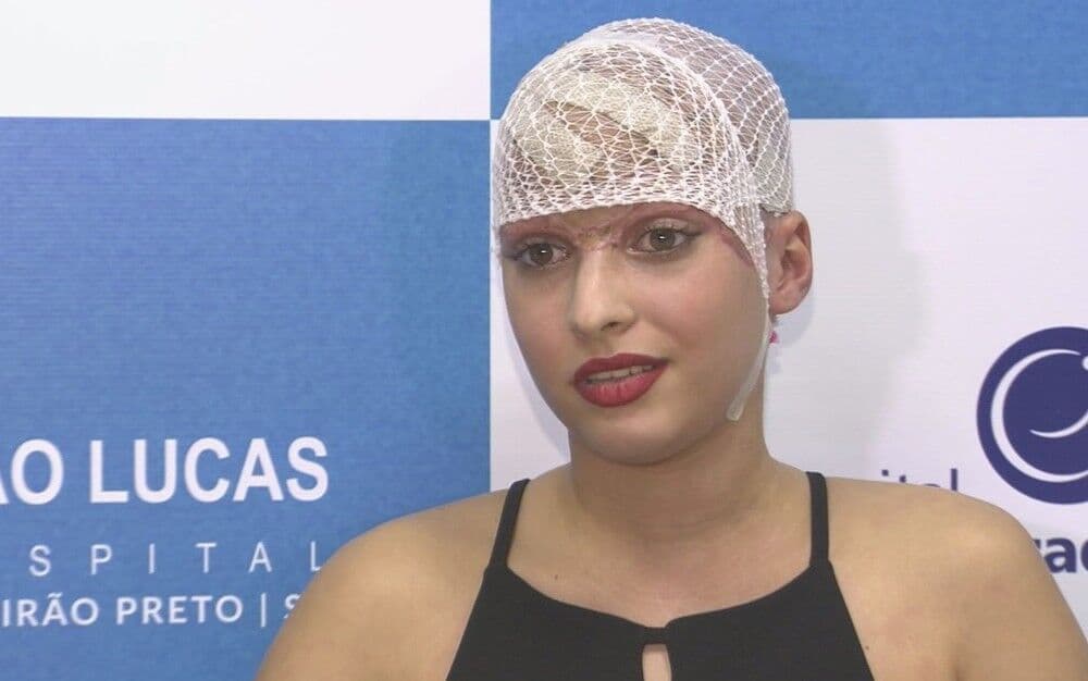 Jovem que perdeu couro cabeludo em kart receberá alta de hospital em Ribeirão neste sábado