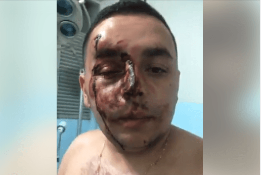 Vereador de Tavares é espancado e acusa equipe da prefeitura de tentativa de homicídio