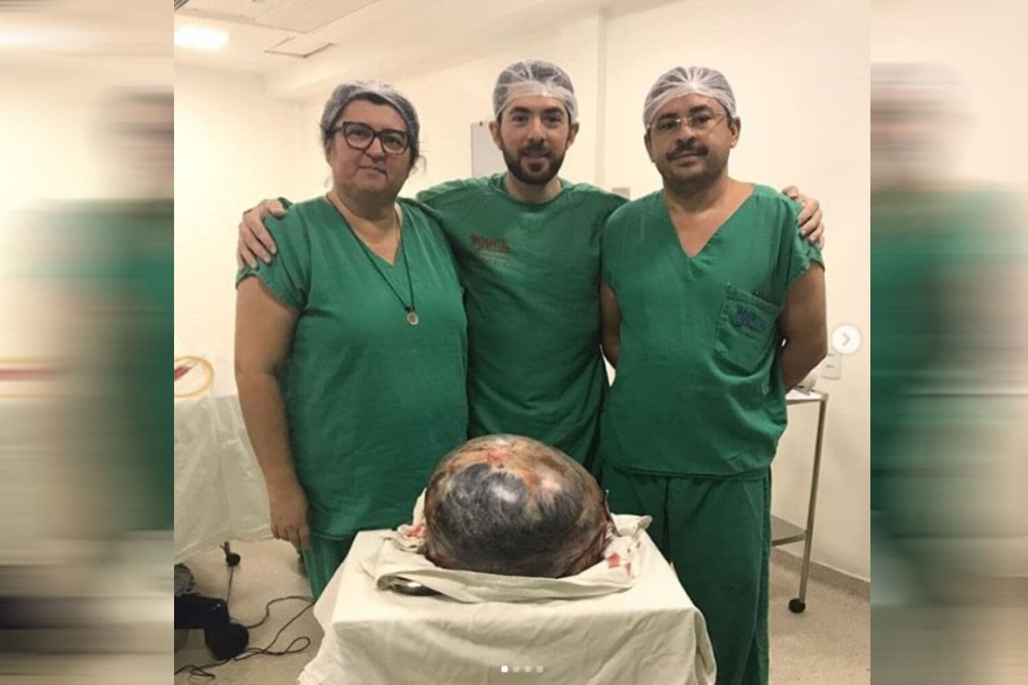 Cisto de 20 quilos é retirado do ovário de paciente em Hospital de Santa Rita