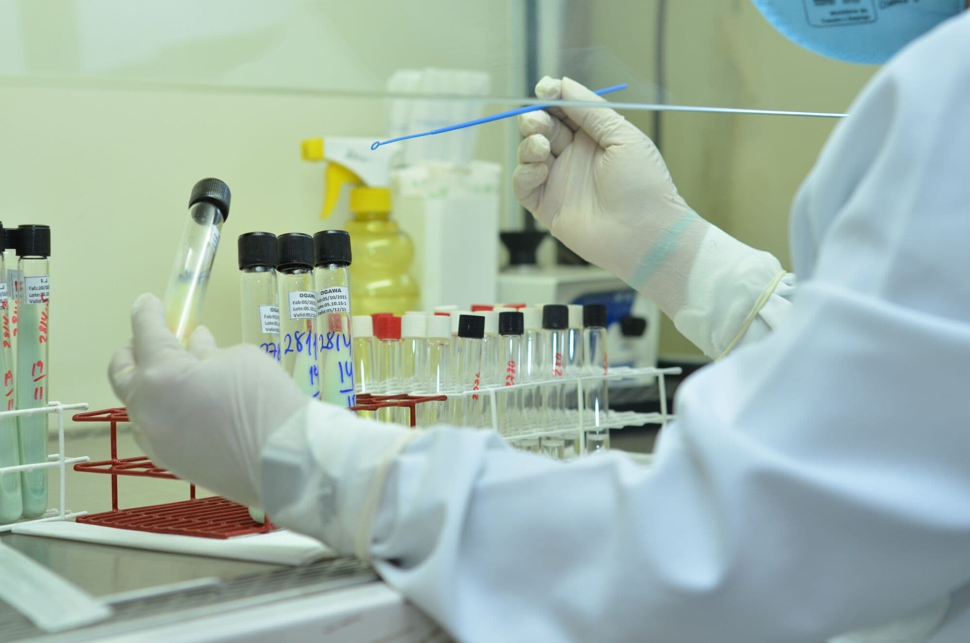 Teste do zika vírus custa até R$ 800 em João Pessoa