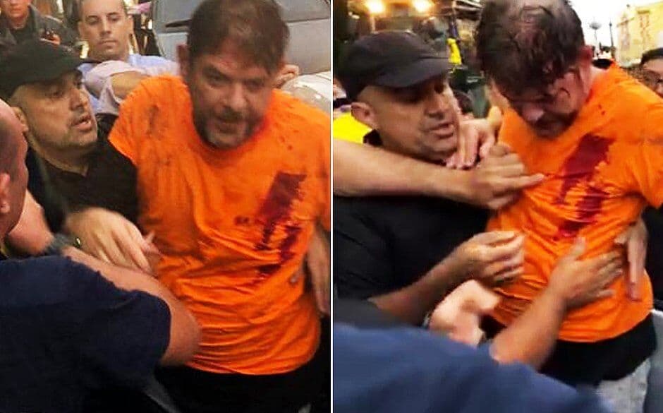 Senador Cid Gomes deixa a UTI de hospital após ser baleado em manifestação de policiais no Ceará