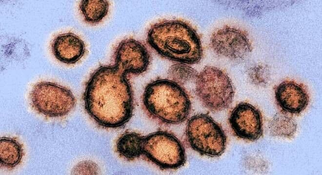 Coronavírus: com 2 casos confirmados, Brasil monitora 433 suspeitos