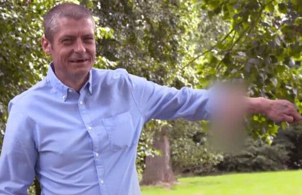 Após perder o pênis em infecção, britânico tem órgão construído no braço