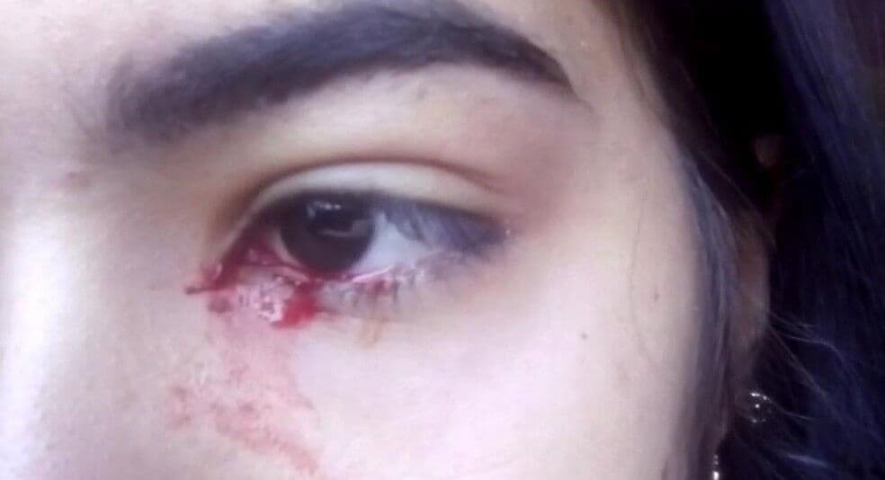 Adolescente 'chora sangue' e intriga família no interior de São Paulo