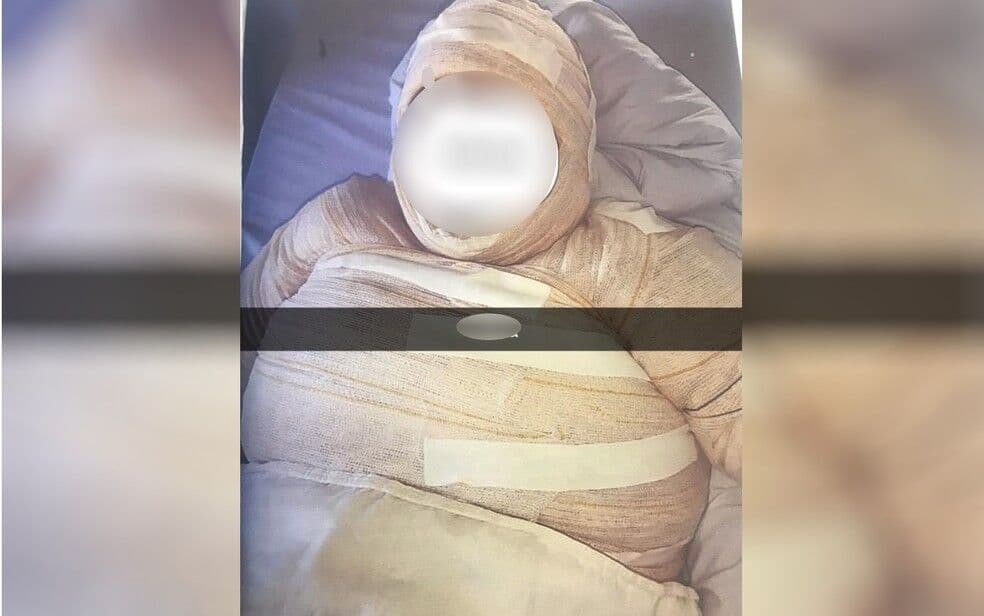 Mulher é presa suspeita de atear fogo na companheira por ciúmes e de dar nome falso em hospital para tentar evitar ser descoberta