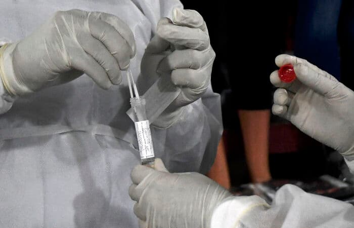 Estudo aponta primeiras reinfecções por Covid-19 no Recife