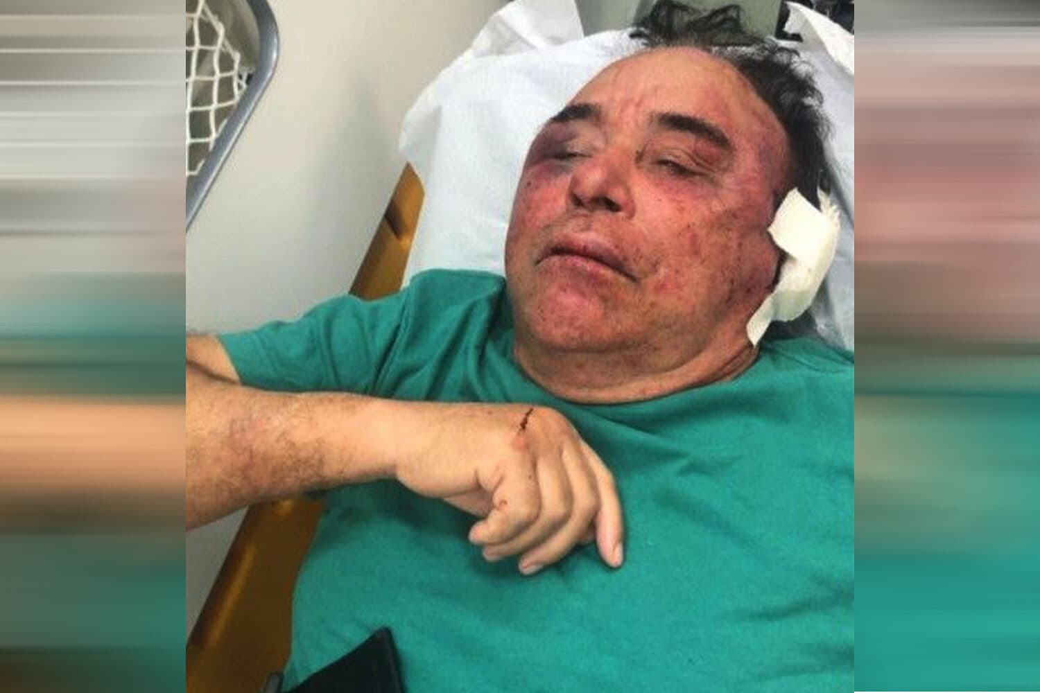 Candidato a prefeito de Santa Teresinha espancado por grupo apresenta piora e é transferido para Hospital de João Pessoa