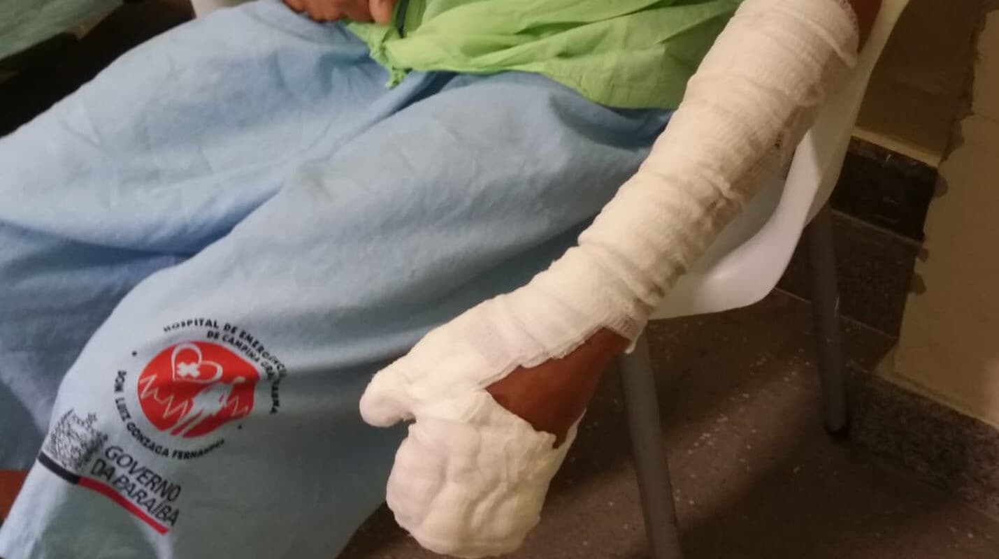 Hospital de Trauma de Campina Grande divulga balanço de atendimento na véspera de São João