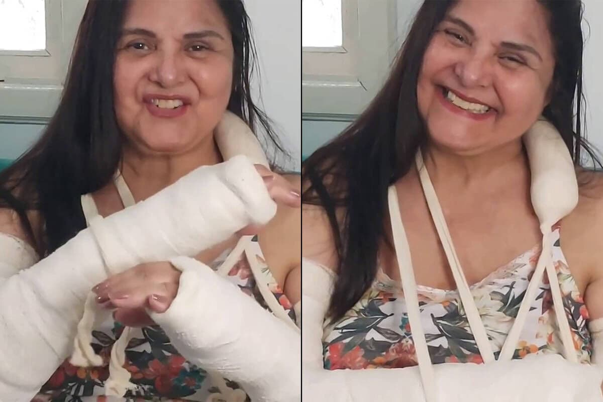 Atriz Elizangela sofre acidente em casa e fratura antebraços