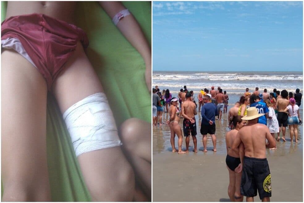 Menino de 11 anos é ferido por tubarão, e animal provoca pânico em praia de São Paulo