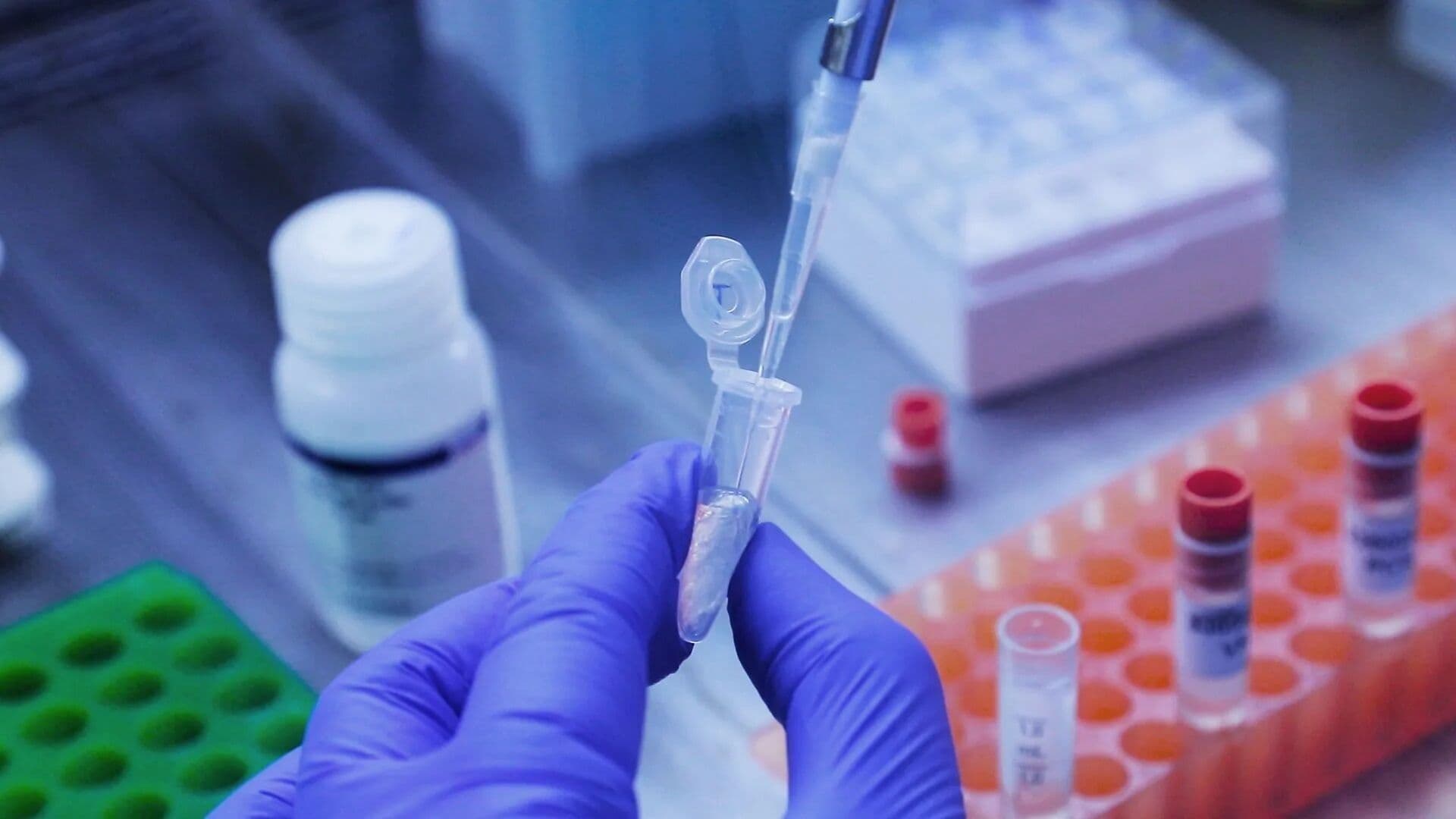 Brasil registra 1º caso de Covid causado pela variante ômicron X