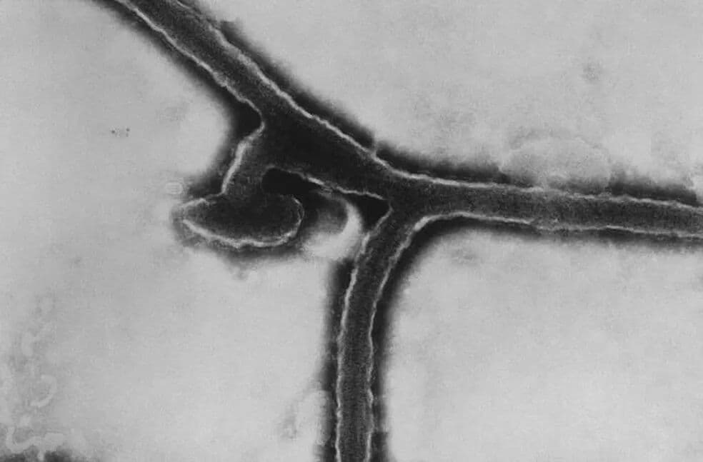 Criança morre infectada pelo Marburg, vírus primo do Ebola, em Gana, na África