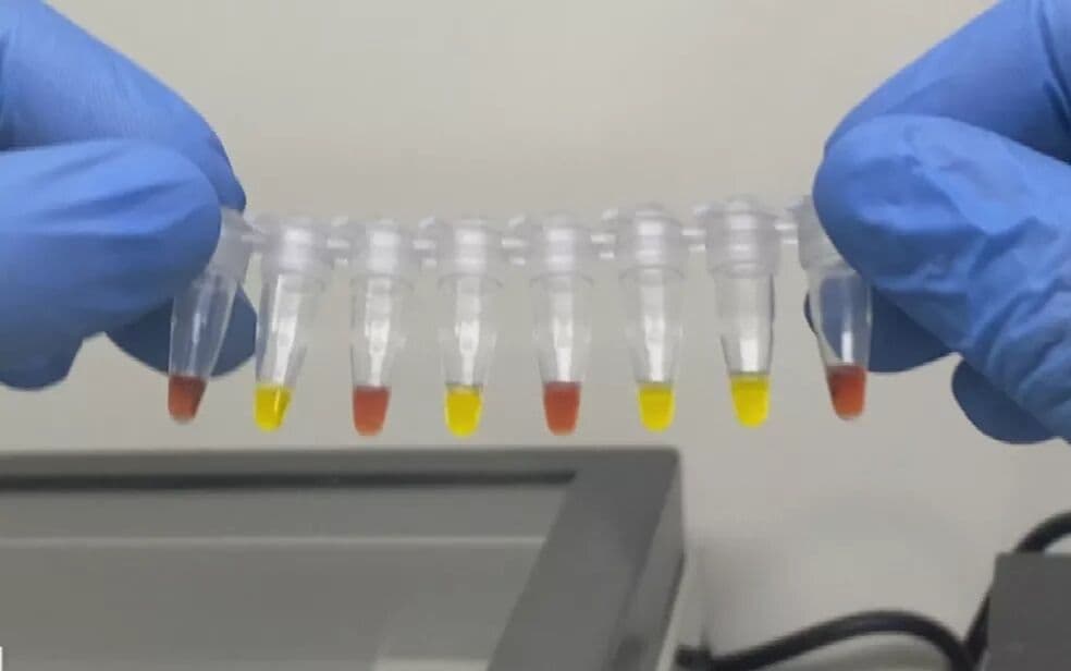 778 pessoas que tiveram sintomas de coronavírus fizeram teste rápido em João Pessoa