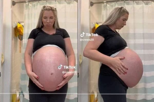 É real? Grávida de trigêmeos, mãe choca a web com tamanho da barriga