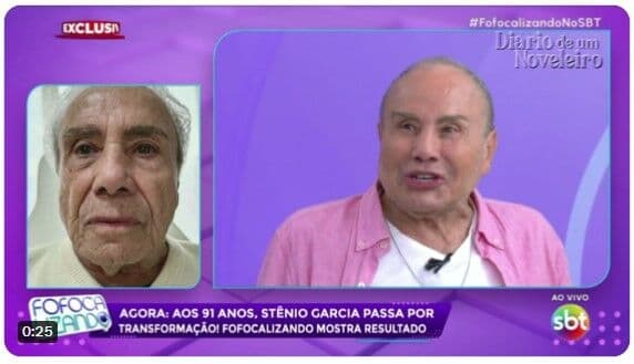 Ator Stênio Garcia faz harmonização facial e choca internautas após mostrar resultado ao vivo em programa de TV