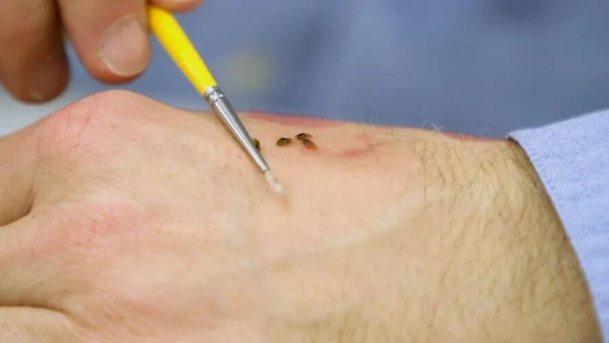 Depois de Paris, Londres é ameaçada pela invasão de percevejos: qual é o risco do inseto, afinal?