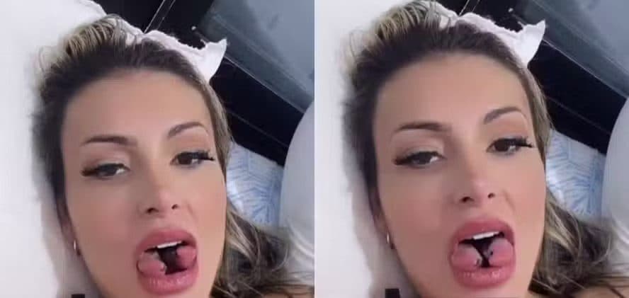 Andressa Urach 'rasga' língua durante cirurgia de bifurcação; entenda procedimento