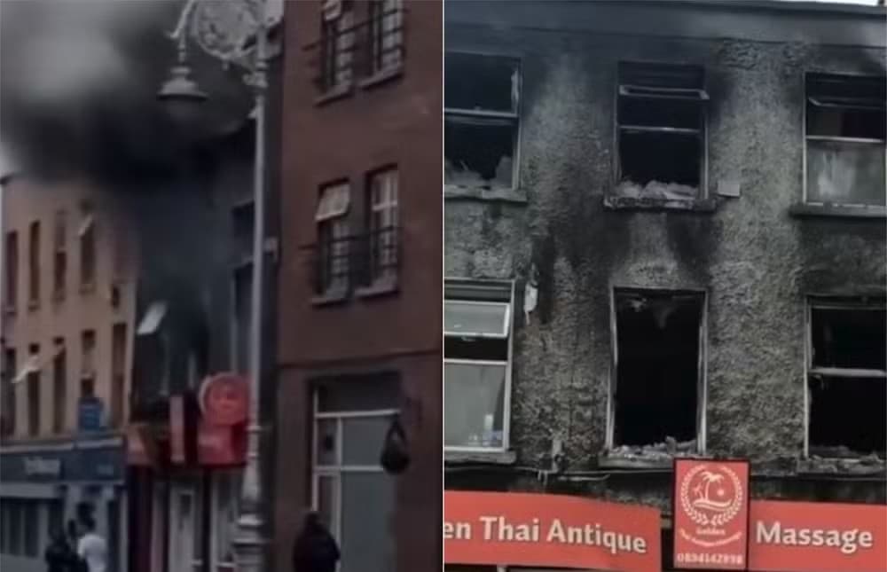 Nordestino é internado em estado grave após incêndio em prédio na Irlanda