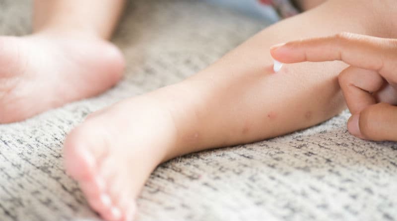 Até 8% das crianças menores de 3 anos podem desenvolver alergia alimentar, especialista alerta para sinais e cuidados