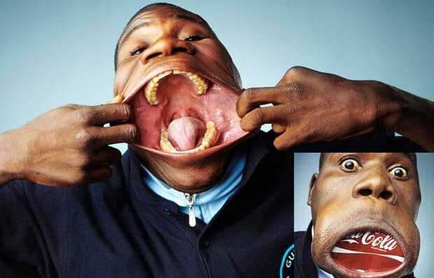 Angolano detém recorde por esticar a boca até 17 centímetros