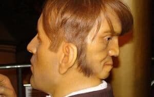 Homens nascem com duas faces e não conseguem operar para arrumar