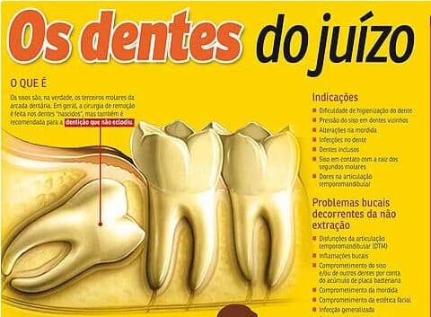 Entenda a importância da extração dos sisos para a saúde bucal