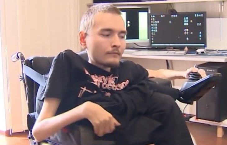 Russo com doença degenerativa pode fazer 1º transplante de cabeça do mundo