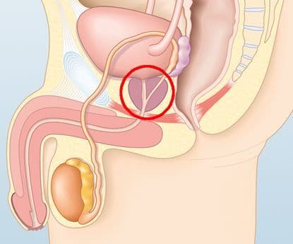 Aumento de tamanho da próstata é normal e tem tratamento, diz especialista