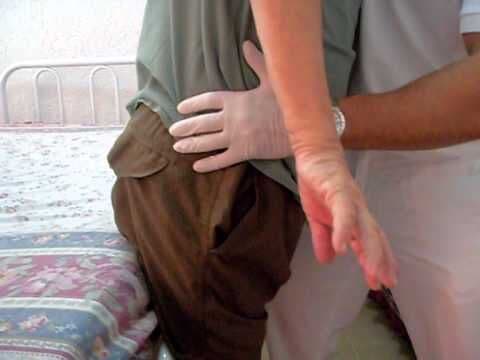 Entenda o que é a síndrome de Guillain-Barré