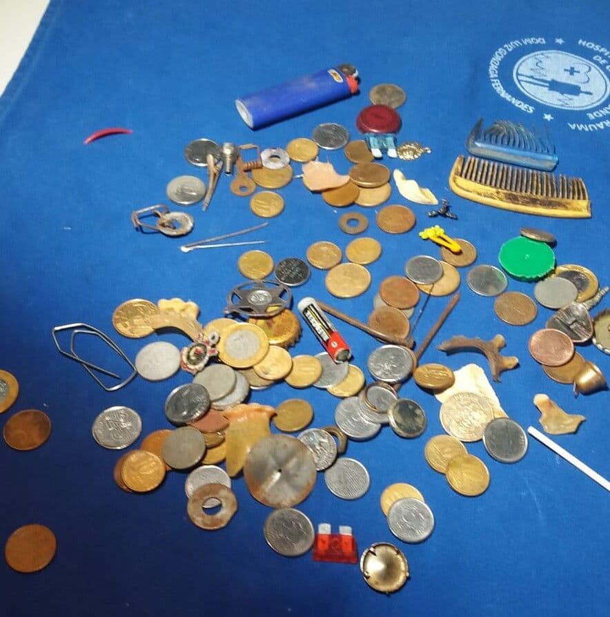 De isqueiro a pente: Trauma de CG registra retirada de mais de 3 mil corpos estranhos em 2019