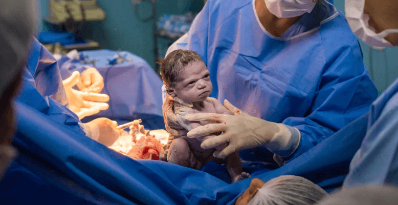 Bebê nasce zangada e foto viraliza na internet