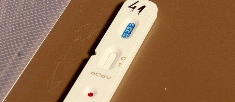 Coronavírus: carga com 726 mil testes para diagnóstico da doença chega ao Brasil