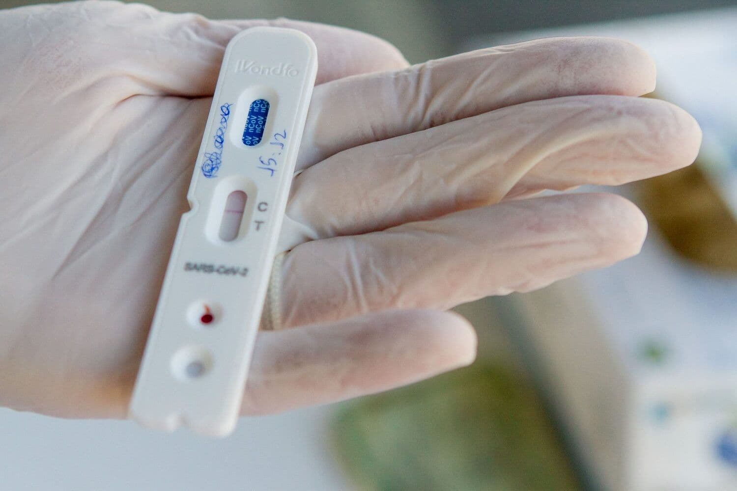 Caminhoneiros em João Pessoa e Cabedelo passam por teste de Covid-19 nesta segunda