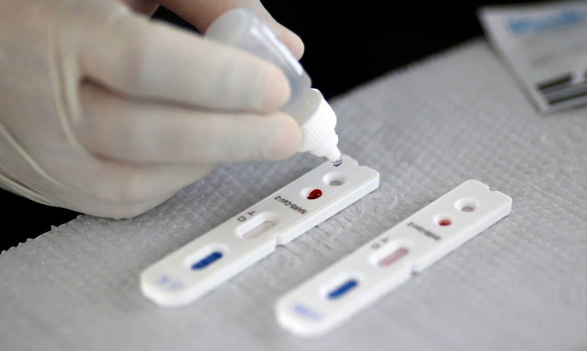 Paraíba registra 324 novos casos de Covid-19 em 24h; total de mortos chega a 1.302 e mais de 61 mil infectados