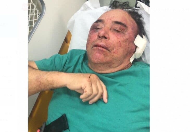 Candidato a prefeito tem casa invadida e é espancado por grupo armado na Paraíba