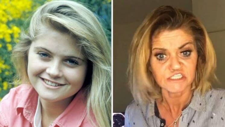 Atriz britânica é submetida a cirurgia após ter rosto corroído por abuso de cocaína