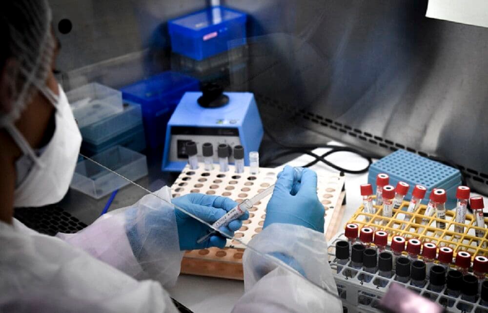 Paraíba confirma 93 novos casos de Covid-19 e 09 óbitos em 24h; total de mortos chega a 3.439 e 153.649 infectados