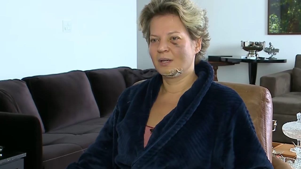 Joice Hasselmann: polícia do DF descarta agressão e diz que deputada caiu da própria altura