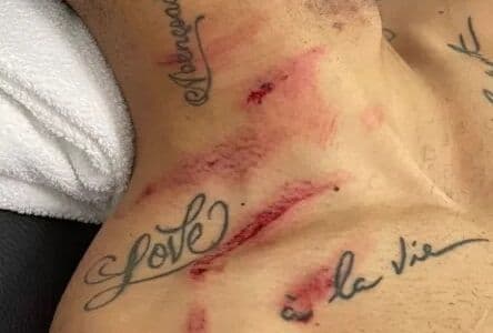 Depois de ser atingido por goleiro equatoriano, Matheus Cunha brinca e diz que terá problemas para explicar lesão