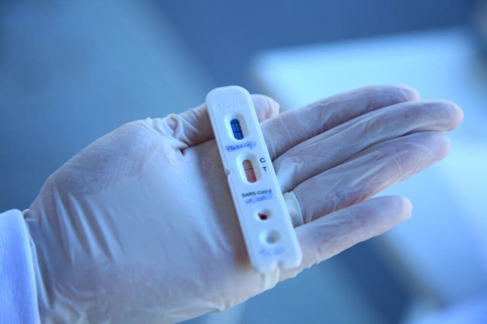 Paraíba confirma 25 mortes e 1.783 novos casos de Covid-19 nesta terça-feira