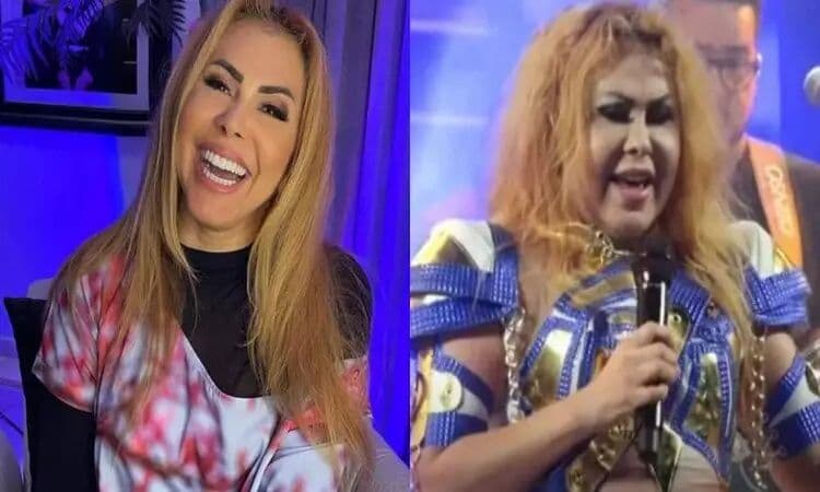 Cantora Joelma passa por exames para tratamento de sequelas da covid
