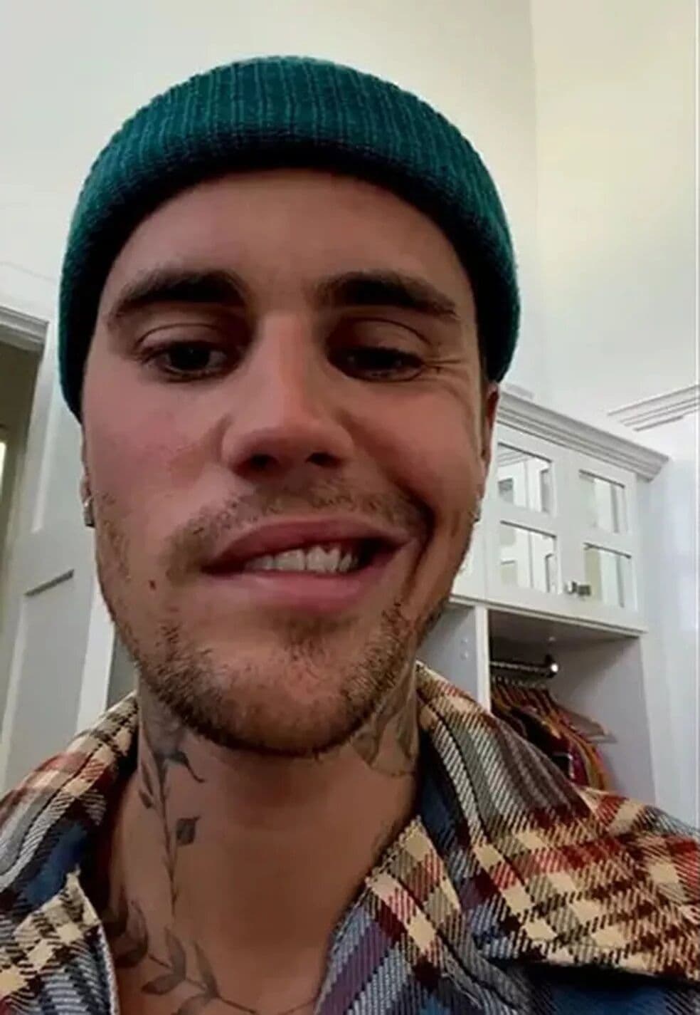 Justin Bieber faz vídeo com metade do rosto paralisado e diz que sofre de síndrome de Ramsay Hunt