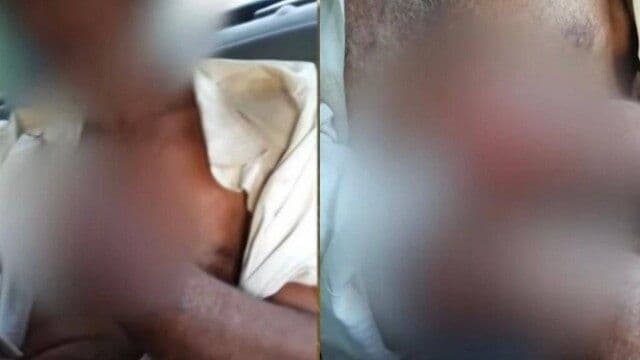 Fazendeiro decepa mão de funcionário que não recebeu salário e furtou galinha, no Paraná