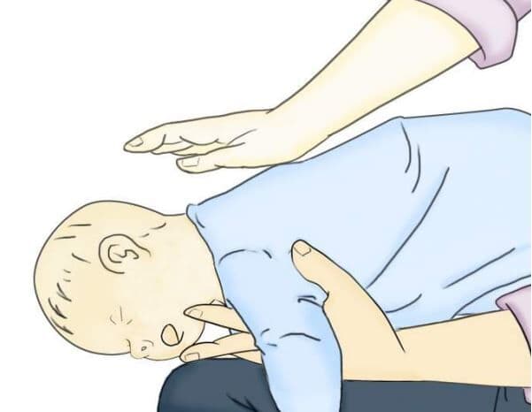 Bebê se engasga e é salvo por técnico de enfermagem em Patos